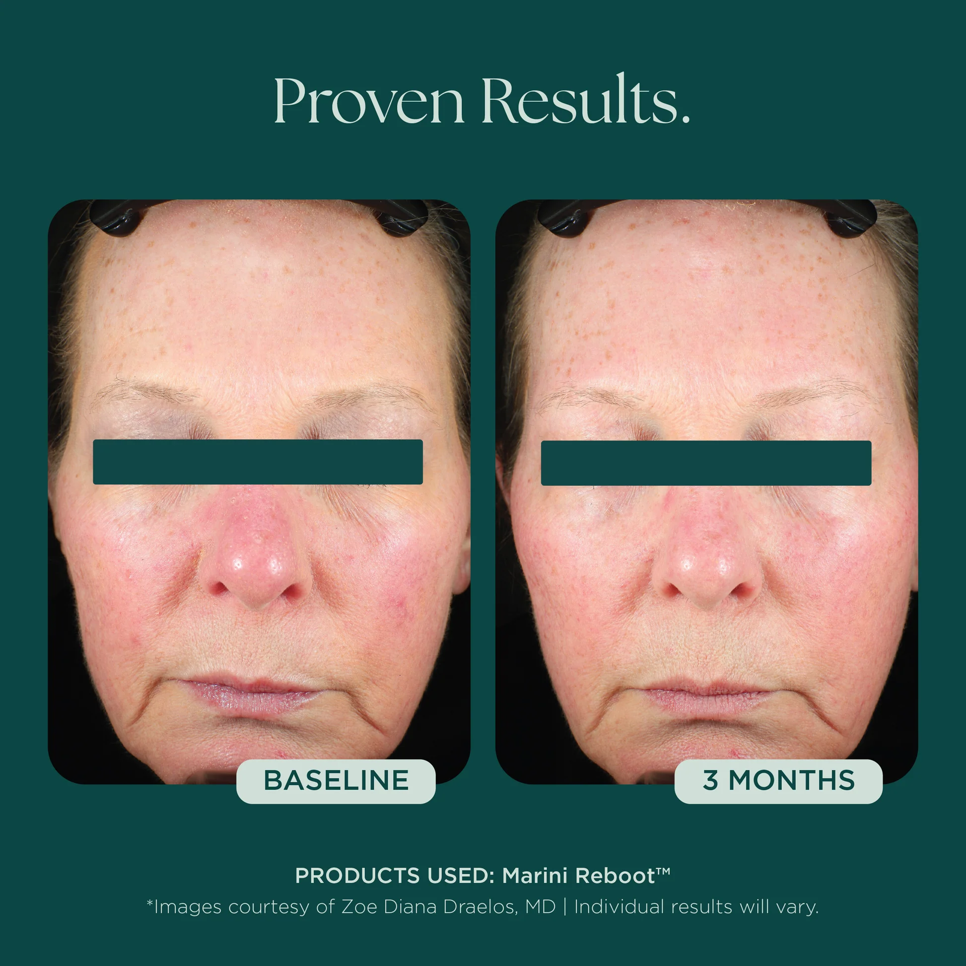 Marini SkinSolutions - Marini Reboot® PDRN Face Serum | SKINSTUDIO